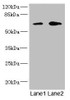 Western blot<br />
 All lanes: REC8 antibody at 1.67µg/ml<br />
 Lane 1: Jurkat whole cell lysate<br />
 Lane 2: HT29 whole cell lysate<br />
 Secondary<br />
 Goat polyclonal to rabbit IgG at 1/10000 dilution<br />
 Predicted band size: 63, 61 kDa<br />
 Observed band size: 63 kDa<br />