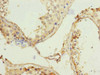 Immunohistochemistry of paraffin-embedded human testis tissue using CSB-PA019535ESR1HU at dilution of 1:100