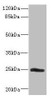 Western blot<br />
 All lanes: SNRPB2 antibody IgG at 2.26µg/ml + Mouse kidney tissue<br />
 Secondary<br />
 Goat polyclonal to rabbit IgG at 1/10000 dilution<br />
 Predicted band size: 25 kDa<br />
 Observed band size: 25 kDa<br />
