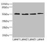 Western blot<br />
 All lanes: SQRDL antibody at 4.67µg/ml<br />
 Lane 1: A549 whole cell lysate<br />
 Lane 2: A431 whole cell lysate<br />
 Lane 3: Hela whole cell lysate<br />
 Lane 4: HepG2 whole cell lysate<br />
 Secondary<br />
 Goat polyclonal to rabbit IgG at 1/10000 dilution<br />
 Predicted band size: 50 kDa<br />
 Observed band size: 50 kDa<br />