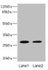 Western blot<br />
 All lanes: TPK1 antibody at 0.78µg/ml<br />
 Lane 1: Mouse liver tissue<br />
 Lane 2: Mouse kidney tissue<br />
 Secondary<br />
 Goat polyclonal to rabbit IgG at 1/10000 dilution<br />
 Predicted band size: 28, 14 kDa<br />
 Observed band size: 28 kDa<br />