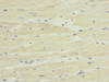 Immunohistochemistry of paraffin-embedded human heart tissue using CSB-PA024103ESR2HU at dilution of 1:100