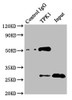 Immunoprecipitating TPK1 in Mouse kidney tissue<br />
 Lane 1: Rabbit control IgG instead of CSB-PA024103ESR2HU in Mouse kidney tissue.
 For western blotting, a HRP-conjugated Protein G antibody was used as the secondary antibody (1/2000) <br />
 Lane 2: CSB-PA024103ESR2HU (8µg) + Mouse kidney tissue (500µg) <br />
 Lane 3: Mouse kidney tissue (10µg) <br />