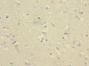 Immunohistochemistry of paraffin-embedded human brain tissue using CSB-PA810284ESR1HU at dilution of 1:100