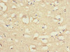 Immunohistochemistry of paraffin-embedded human brain tissue using CSB-PA810284ESR2HU at dilution of 1:100