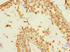 Immunohistochemistry of paraffin-embedded human testis tissue using CSB-PA880111ESR1HU at dilution of 1:100