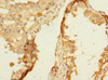 Immunohistochemistry of paraffin-embedded human testis tissue using CSB-PA880111ESR2HU at dilution of 1:100