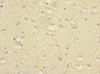 Immunohistochemistry of paraffin-embedded human brain tissue using CSB-PA880111ESR2HU at dilution of 1:100