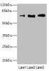 Western blot<br />
 All lanes: CD180 antibody at 3.95µg/ml<br />
 Lane 1: A549 whole cell lysate<br />
 Lane 2: A431 whole cell lysate<br />
 Lane 3: HepG2 whole cell lysate<br />
 Secondary<br />
 Goat polyclonal to rabbit IgG at 1/10000 dilution<br />
 Predicted band size: 74 kDa<br />
 Observed band size: 74 kDa<br />