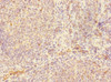 Immunohistochemistry of paraffin-embedded human tonsil tissue using CSB-PA859931ESR2HU at dilution of 1:100
