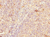 Immunohistochemistry of paraffin-embedded human tonsil tissue using CSB-PA887023ESR1HU at dilution of 1:100