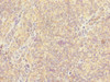Immunohistochemistry of paraffin-embedded human tonsil tissue using CSB-PA887023ESR2HU at dilution of 1:100