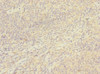 Immunohistochemistry of paraffin-embedded human tonsil tissue using CSB-PA004967ESR1HU at dilution of 1:100