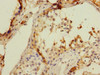 Immunohistochemistry of paraffin-embedded human testis tissue using CSB-PA004967ESR1HU at dilution of 1:100
