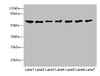 Western blot<br />
 All lanes: CHRNA9 antibody at 0.75µg/ml<br />
 Lane 1: Mouse brain tissue<br />
 Lane 2: Jurkat whole cell lysate<br />
 Lane 3: Hela whole cell lysate<br />
 Lane 4: A549 whole cell lysate<br />
 Lane 5: A431 whole cell lysate<br />
 Lane 6: HepG2 whole cell lysate<br />
 Lane 7: MCF-7 whole cell lysate<br />
 Secondary<br />
 Goat polyclonal to rabbit IgG at 1/10000 dilution<br />
 Predicted band size: 55 kDa<br />
 Observed band size: 55 kDa<br />