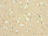 Immunohistochemistry of paraffin-embedded human brain tissue using CSB-PA887022ESR2HU at dilution of 1:100