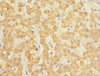 Immunohistochemistry of paraffin-embedded human liver tissue using CSB-PA885789ESR1HU at dilution of 1:100