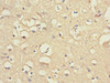 Immunohistochemistry of paraffin-embedded human brain tissue using CSB-PA009143ESR1HU at dilution of 1:100