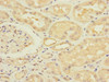 Immunohistochemistry of paraffin-embedded human kidney tissue using CSB-PA352689ESR1HU at dilution of 1:100