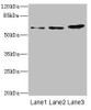 Western blot<br />
 All lanes: ERVFRD-1 antibody at 3.93µg/ml<br />
 Lane 1: Hela whole cell lysate<br />
 Lane 2: HepG2 whole cell lysate<br />
 Lane 3: A431 whole cell lysate<br />
 Secondary<br />
 Goat polyclonal to rabbit IgG at 1/10000 dilution<br />
 Predicted band size: 60 kDa<br />
 Observed band size: 60 kDa<br />