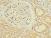Immunohistochemistry of paraffin-embedded human kidney tissue using CSB-PA352689ESR2HU at dilution of 1:100