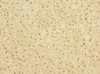 Immunohistochemistry of paraffin-embedded human adrenal gland tissue using CSB-PA352689ESR2HU at dilution of 1:100