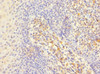 Immunohistochemistry of paraffin-embedded human tonsil tissue using CSB-PA011874ESR1HU at dilution of 1:100