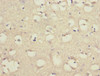 Immunohistochemistry of paraffin-embedded human brain tissue using CSB-PA839321ESR2HU at dilution of 1:100