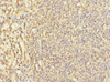 Immunohistochemistry of paraffin-embedded human tonsil tissue using CSB-PA884511ESR2HU at dilution of 1:100