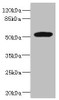 Western blot<br />
 All lanes: MARCO antibody at 1.97µg/ml + Jurkat whole cell lysate<br />
 Secondary<br />
 Goat polyclonal to rabbit IgG at 1/10000 dilution<br />
 Predicted band size: 53, 44 kDa<br />
 Observed band size: 53 kDa<br />