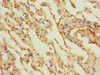 Immunohistochemistry of paraffin-embedded human lung tissue using CSB-PA880072ESR2HU at dilution of 1:100