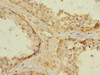 Immunohistochemistry of paraffin-embedded human testis tissue using CSB-PA883410ESR1HU at dilution of 1:100