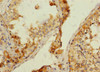 Immunohistochemistry of paraffin-embedded human testis tissue using CSB-PA883410ESR2HU at dilution of 1:100