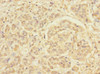 Immunohistochemistry of paraffin-embedded human pancreatic cancer using CSB-PA873646DSR1HU at dilution of 1:100