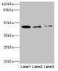 Western blot<br />
 All lanes: SIGIRR antibody at 1.77µg/ml<br />
 Lane 1: Mouse liver tissue<br />
 Lane 2: Mouse kidney tissue<br />
 Lane 3: MCF-7 whole cell lysate<br />
 Secondary<br />
 Goat polyclonal to rabbit IgG at 1/10000 dilution<br />
 Predicted band size: 46, 56 kDa<br />
 Observed band size: 46 kDa<br />