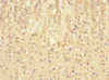 Immunohistochemistry of paraffin-embedded human adrenal gland tissue using CSB-PA743558ESR1HU at dilution of 1:100