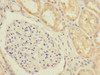 Immunohistochemistry of paraffin-embedded human kidney tissue using CSB-PA021438ESR1HU at dilution of 1:100