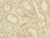 Immunohistochemistry of paraffin-embedded human kidney tissue using CSB-PA021438ESR2HU at dilution of 1:100