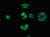 Immunofluorescent analysis of HepG2 cells using CSB-PA021438ESR2HU at dilution of 1:100 and Alexa Fluor 488-congugated AffiniPure Goat Anti-Rabbit IgG (H+L)