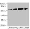 Western blot<br />
 All lanes: CHRNA6 antibody at 3.72µg/ml<br />
 Lane 1: A431 whole cell lysate<br />
 Lane 2: A549 whole cell lysate<br />
 Lane 3: Hela whole cell lysate<br />
 Lane 4: HepG2 whole cell lysate<br />
 Secondary<br />
 Goat polyclonal to rabbit IgG at 1/10000 dilution<br />
 Predicted band size: 57, 56 kDa<br />
 Observed band size: 57 kDa<br />