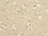 Immunohistochemistry of paraffin-embedded human brain tissue using CSB-PA620896ESR2HU at dilution of 1:100
