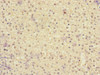 Immunohistochemistry of paraffin-embedded human adrenal gland tissue using CSB-PA887035ESR1HU at dilution of 1:100