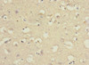 Immunohistochemistry of paraffin-embedded human brain tissue using CSB-PA889183ESR1HU at dilution of 1:100