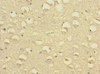 Immunohistochemistry of paraffin-embedded human brain tissue using CSB-PA021469ESR1HU at dilution of 1:100