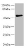 Western blot<br />
 All lanes: FCRL2 antibody at 1.78µg/ml + 293T whole cell lysate<br />
 Secondary<br />
 Goat polyclonal to rabbit IgG at 1/10000 dilution<br />
 Predicted band size: 56, 28, 21, 16, 23 kDa<br />
 Observed band size: 56 kDa<br />