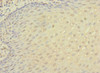 Immunohistochemistry of paraffin-embedded human tonsil tissue using CSB-PA011879ESR1HU at dilution of 1:100