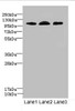 Western blot<br />
 All lanes: EPHB4 antibody at 2.71µg/ml<br />
 Lane 1: A549 whole cell lysate<br />
 Lane 2: 293T whole cell lysate<br />
 Lane 3: Hela whole cell lysate<br />
 Secondary<br />
 Goat polyclonal to rabbit IgG at 1/10000 dilution<br />
 Predicted band size: 109, 56, 34, 46 kDa<br />
 Observed band size: 109 kDa<br />