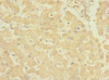 Immunohistochemistry of paraffin-embedded human liver tissue using CSB-PA007732ESR1HU at dilution of 1:100