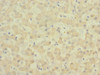 Immunohistochemistry of paraffin-embedded human liver tissue using CSB-PA007732ESR2HU at dilution of 1:100