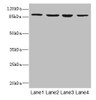 Western blot<br />
 All lanes: ITGB7 antibody at 5.04µg/ml<br />
 Lane 1: MCF-7 whole cell lysate<br />
 Lane 2: HepG2 whole cell lysate<br />
 Lane 3: A549 whole cell lysate<br />
 Lane 4: K562 whole cell lysate<br />
 Secondary<br />
 Goat polyclonal to rabbit IgG at 1/10000 dilution<br />
 Predicted band size: 87, 72 kDa<br />
 Observed band size: 87 kDa<br />